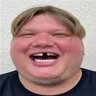 Конфиг На NixWare RAGE - HVH  с Крутилкой и Без неё - БРО ДА ТЫ ПРЯМ СИМПЛУХА